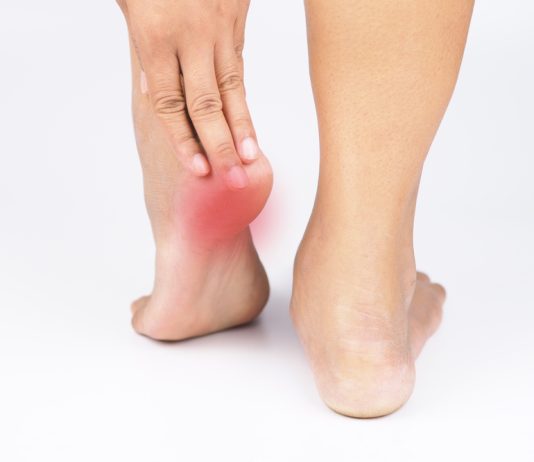 Does Plantar Fasciitis Worsen If Gait Abnormalities Are Not Corrected plantar fascia tension