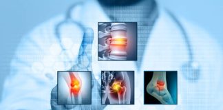 Understanding Spondylosis and How It Affects Your Spine Spondylosis Treatment