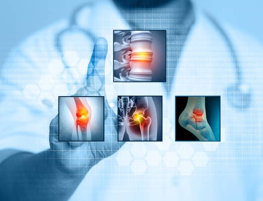 Understanding Spondylosis and How It Affects Your Spine Spondylosis Treatment