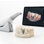5 Essential Resources That Support a Complete Dental Implant Care Plan in Plainview, NY dental implants Plainview NY